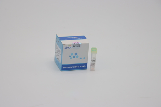Un trousse de essai acide nucléique témoin nasal d'écouvillon de la CE de trousse d'ACP de grippe d'étape