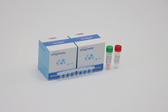 CE fluorescent quantitatif de temps réel du trousse POCT de détection d'ACP de virus d'HIV