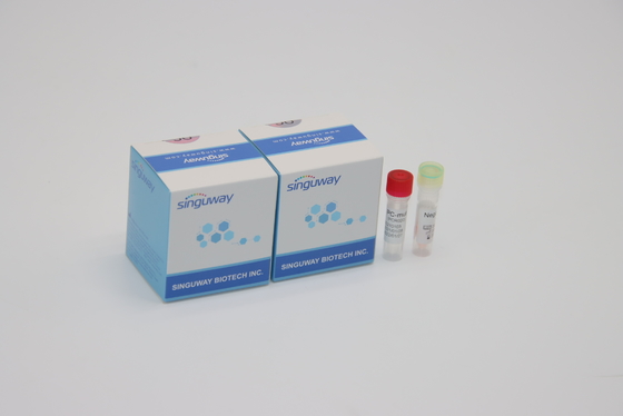 trousse fluorescent quantitatif IVD de détection d'ACP pour toute la Corona Virus Mutations