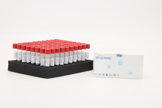 trousse d'extraction d'ARN de réactif de libération témoin de virus de la grippe d'essai d'ACP de Singuway