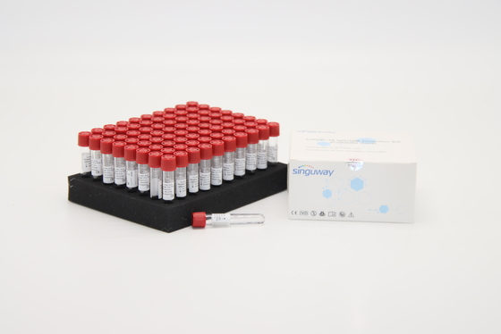 80 essais extrêmement sensibles 1 ACP acide nucléique de trousse For d'extraction d'étape