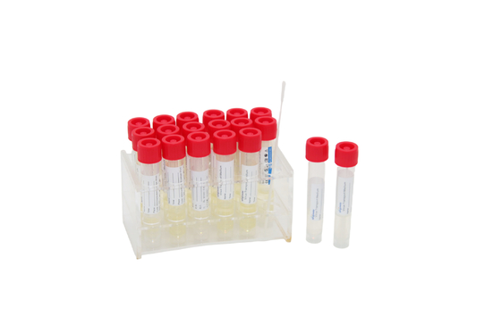 virus 2mL jetable prélevant le tube à essai de trousse Medical VTM avec le bâton d'écouvillon de gorge