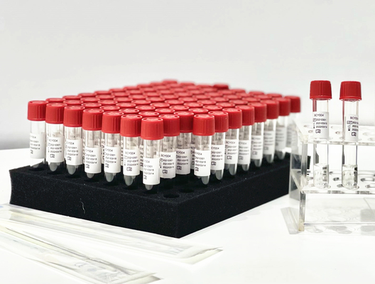 Une extraction trousse From Patient Pharynx Swab d'ACP de réactif de libération témoin d'étape