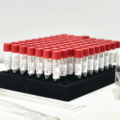Tube nasal du kit 0.5mL/d'extraction de réactif de libération témoin d'écouvillon de pharynx sans prétraitement