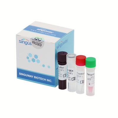 Kit en temps réel diagnostique quantitatif 40uL d'ACP d'HIV pour le virus d'immunodéficience humaine